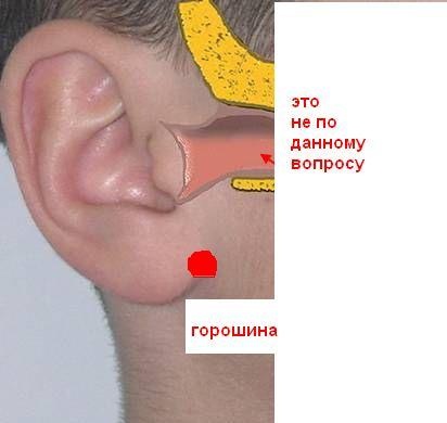 Атерома: можно не лечить и в чем ее скрытая опасность